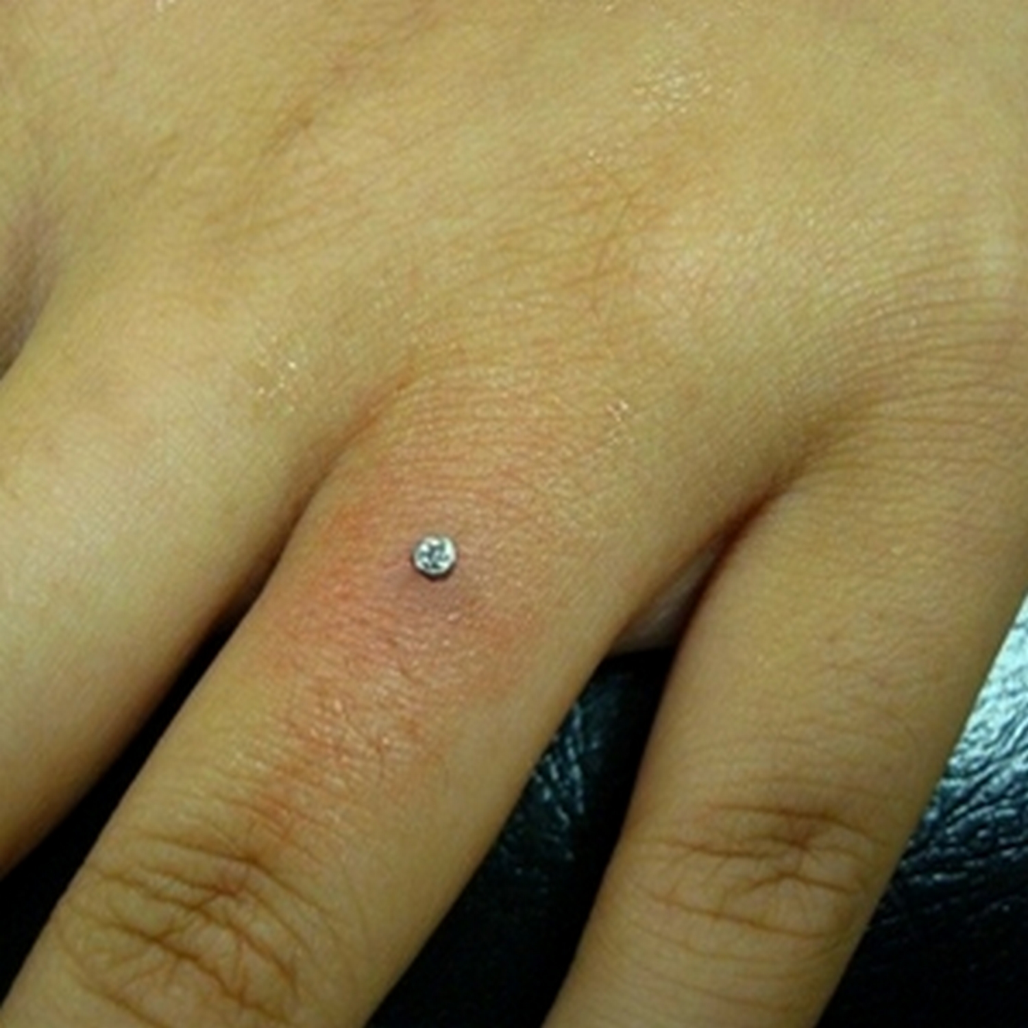 Parmak Dermal Piercing Delimi.